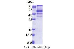SDS-PAGE (SDS) image for EBNA1 Binding Protein 2 (EBNA1BP2) (AA 1-306) protein (His tag) (ABIN5853242) (EBNA1BP2 Protein (AA 1-306) (His tag))