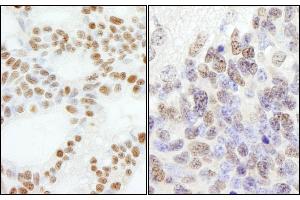 Immunohistochemistry (IHC) image for anti-Polymerase (DNA Directed), epsilon 3 (p17 Subunit) (POLE3) (AA 97-147) antibody (ABIN7453486)