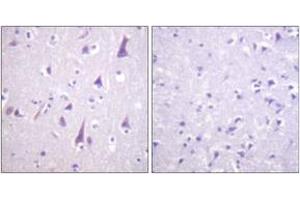 Immunohistochemistry analysis of paraffin-embedded human brain, using GFAP (Phospho-Ser38) Antibody. (GFAP anticorps  (pSer38))