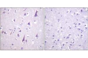 Immunohistochemistry analysis of paraffin-embedded human brain, using GFAP (Phospho-Ser38) Antibody. (GFAP anticorps  (pSer38))