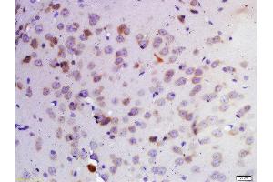 Formalin-fixed and paraffin embedded rat brain labeled with Rabbit Anti-KDM1 Polyclonal Antibody, Unconjugated 1:200 followed by conjugation to the secondary antibody and DAB staining (LSD1 anticorps  (AA 101-200))