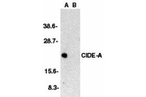 Western Blotting (WB) image for anti-Cell Death-Inducing DFFA-Like Effector A (CIDEA) (C-Term) antibody (ABIN1030333) (CIDEA anticorps  (C-Term))