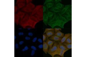 DIAPH1 Mouse Monoclonal Antibody staining Hela cells by IF/ICC. (DIAPH1 anticorps  (N-Term))