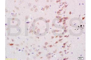 Formalin-fixed and paraffin embedded mouse brain labeled with Rabbit Anti Neurocan Polyclonal Antibody, Unconjugated (ABIN737001) at 1:200 followed by conjugation to the secondary antibody and DAB staining (Neurocan anticorps  (AA 1185-1257))