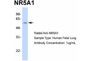 Host:  Rabbit  Target Name:  NR5A1  Sample Type:  Human Fetal Lung  Antibody Dilution:  1.