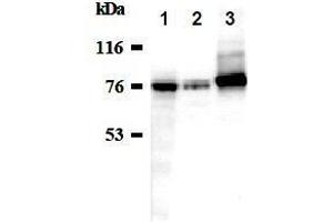Western Blotting (WB) image for anti-Sodium Potassium ATPase, alpha1 (ATP1A1) antibody (ABIN1449189) (ATP1A1 anticorps)