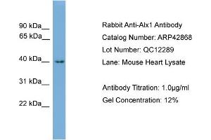 WB Suggested Anti-Alx1 Antibody Titration:  0. (ALX1 anticorps  (N-Term))