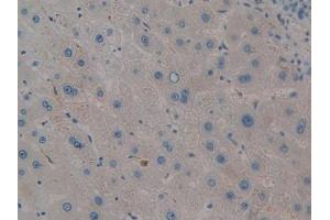 IHC-P analysis of Human Liver Tissue, with DAB staining. (PIM2 anticorps  (AA 82-291))