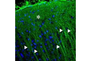 Expression of P2X2 receptor in rat neocortexImmunohistochemical staining of rat neocortex with Anti-P2X2 Receptor Antibody (ABIN7237790, ABIN7316699 and ABIN7316700). (Purinergic Receptor P2X, Ligand Gated Ion Channel 2 (P2RX2) Peptide)
