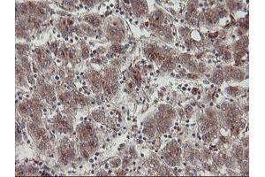 Image no. 8 for anti-Diphthamide Biosynthesis Protein 2 (DPH2) antibody (ABIN1497893) (DPH2 anticorps)