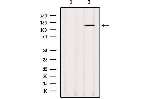 Western blot analysis of extracts from Sp2/0, using LRPPRC Antibody.