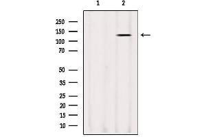 Western blot analysis of extracts from Sp2/0, using LRPPRC Antibody. (LRPPRC anticorps  (Internal Region))