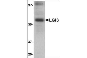 Western blot analysis of LGI3 in human brain tissue lysate with this product at 1 μg/ml. (LGI3 anticorps  (Center))