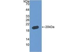 Detection of Recombinant FBLN5, Human using Polyclonal Antibody to Fibulin 5 (FBLN5)