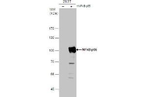 WB Image NFkB p65 antibody detects NFkB p65 protein by western blot analysis.