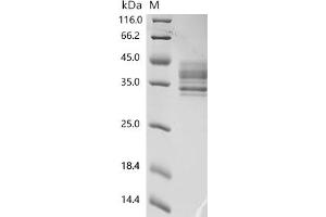(Tris-Glycine gel) Discontinuous SDS-PAGE (reduced) with 5 % enrichment gel and 15 % separation gel.