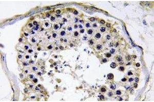 Immunohistochemistry (IHC) analyzes of TRAF6 antibody in paraffin-embedded human testis tissue. (TRAF6 anticorps)