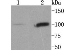 Lane 1: NIH/3T3 lysates, Lane 2: Hela lysates probed with STAT6 (9A7) Monoclonal Antibody  at 1:1000 overnight at 4˚C.