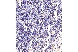 anti-Anaphase Promoting Complex Subunit 2 (ANAPC2) (AA 712-746), (C-Term) antibody