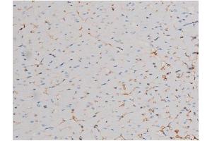 ABIN6267464 at 1/200 staining Mouse heart tissue sections by IHC-P.