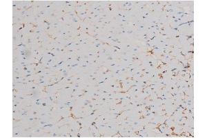 ABIN6267464 at 1/200 staining Mouse heart tissue sections by IHC-P.