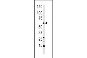 Western blot analysis of anti-MST1 Pab (ABIN392427 and ABIN2842030) in HL60 cell lysate.