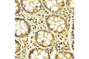Immunohistochemistry of paraffin-embedded Human colon using XRCC3 antibody at dilution of 1:100 (x400 lens).