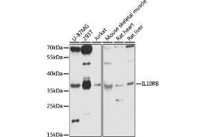 Western blot analysis of extracts of various cell lines, using IL10RB antibody (ABIN7267983) at 1:1000 dilution. (IL10RB anticorps  (AA 20-220))