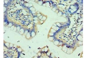 Immunohistochemistry of paraffin-embedded human small intestine tissue using ABIN7146163 at dilution of 1:100