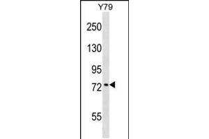 Western blot analysis in Y79 cell line lysates (35ug/lane). (KATNB1 anticorps  (AA 331-359))