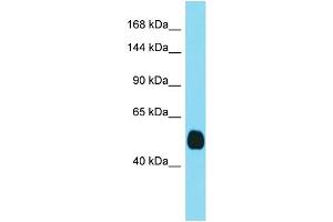 Host: Rabbit  Target Name: Tmprss3  Sample Tissue: Mouse Kidney lysates  Antibody Dilution: 1. (TMPRSS3 anticorps  (C-Term))