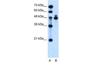 Image no. 2 for anti-Indian Hedgehog (IHH) (AA 24-73) antibody (ABIN205075)