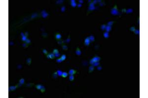 Immunofluorescent analysis of 293T cells using ABIN7162546 at dilution of 1:100 and Alexa Fluor 488-congugated AffiniPure Goat Anti-Rabbit IgG(H+L) (ZDHHC23 anticorps  (AA 187-302))