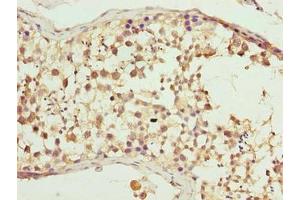 Immunohistochemistry of paraffin-embedded human testis tissue using ABIN7147764 at dilution of 1:100 (WDR16 anticorps  (AA 101-400))