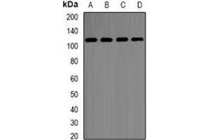 Western blot analysis of Hexokinase 2 expression in SHSY5Y (A), MCF7 (B), K562 (C), COS7 (D) whole cell lysates. (Hexokinase 2 anticorps)