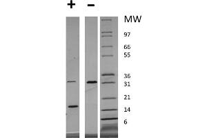 SDS-PAGE of Human Platelet Derived Growth Factor-AA Recombinant Protein SDS-PAGE of Human Platelet Derived Growth Factor-AA Recombinant Protein. (PDGF-AA Homodimer Protéine)