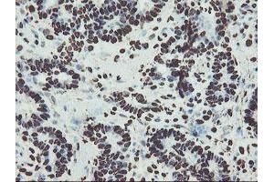 Image no. 18 for anti-Non-POU Domain Containing, Octamer-Binding (NONO) (AA 184-385) antibody (ABIN1491073) (NONO anticorps  (AA 184-385))