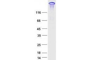 Validation with Western Blot