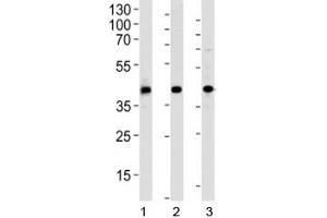 Western blot analysis of 1) human HepG2, 2) mouse kidney and 3) rat spleen tissue lysate using ACADL antibody at 1:1000. (ACADL anticorps  (AA 14-43))