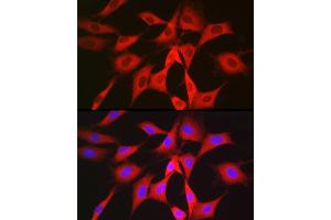 Immunofluorescence analysis of NIH/3T3 cells using PGD Rabbit pAb (ABIN6127314, ABIN6145502, ABIN6145503 and ABIN6223639) at dilution of 1:50 (40x lens).