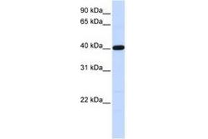 Image no. 1 for anti-Tropomodulin 3 (TMOD3) (AA 36-85) antibody (ABIN6741279) (TMOD3 anticorps  (AA 36-85))
