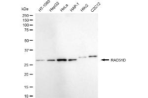 anti-RAD51 Homolog D (RAD51D) antibody