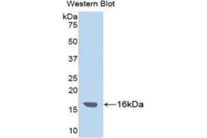 WB of Protein Standard: different control antibodies  against Highly purified E. (ITIH4 Kit ELISA)