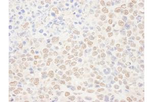 Immunohistochemistry (IHC) image for anti-N-Acetyltransferase 10 (GCN5-Related) (NAT10) (AA 650-700) antibody (ABIN7455028) (NAT10 anticorps  (AA 650-700))