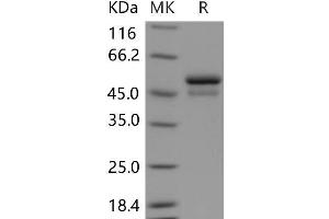 Western Blotting (WB) image for serpin Peptidase Inhibitor, Clade I (neuroserpin), Member 1 (SERPINI1) protein (His tag) (ABIN7320111)