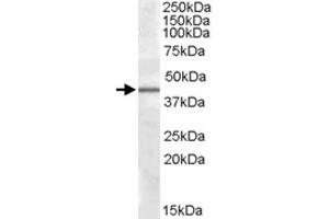 CAMK1D polyclonal antibody  (0. (CAMK1D anticorps)