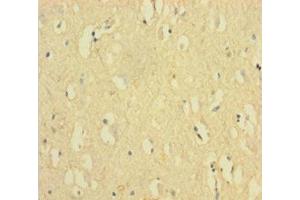 Immunohistochemistry of paraffin-embedded human brain tissue using ABIN7152548 at dilution of 1:100