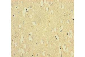 Immunohistochemistry of paraffin-embedded human brain tissue using ABIN7152548 at dilution of 1:100