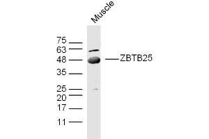 Mouse muscle lysates probed with ZBTB25/ZNF46 Polyclonal Antibody, unconjugated  at 1:300 overnight at 4°C followed by a conjugated secondary antibody at 1:10000 for 90 minutes at 37°C. (ZBTB25 anticorps  (AA 341-435))