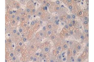 DAB staining on IHC-P; Samples: Human Liver Tissue
